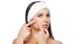 3 Habits that Can Worsen Acne